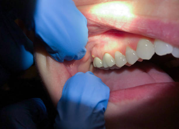 Dentist for Dental Trauma in IL